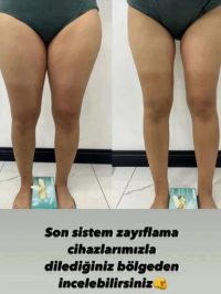 Bölgesel İncelme
